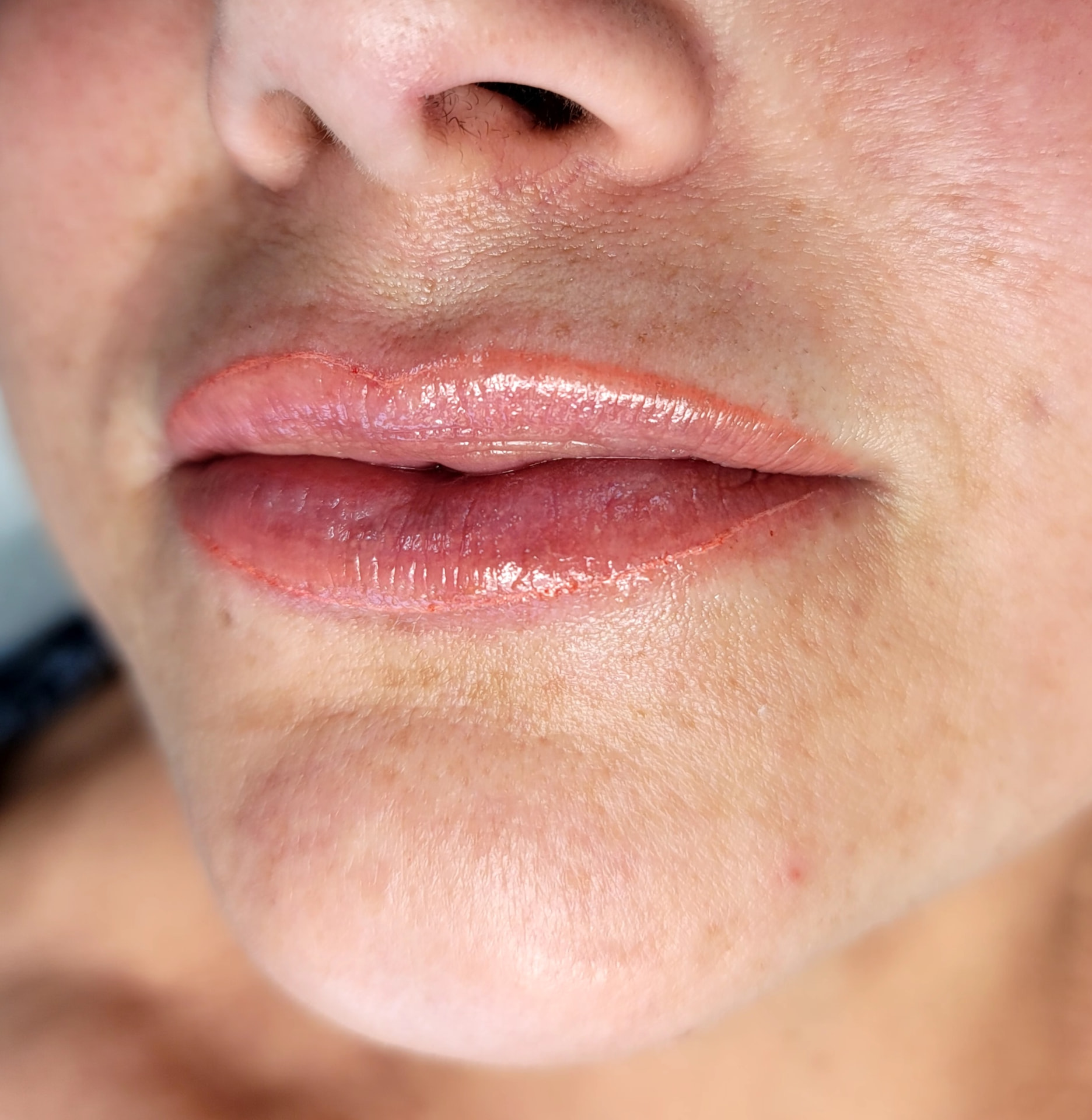 Healed lip blush result
